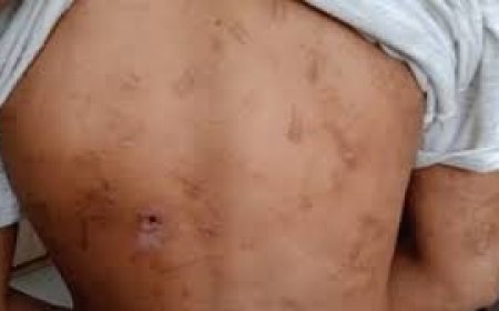 बुआ की क्रूरता दहला देगी, 9 साल की भतीजी के प्राइवेट अंगों को भी नहीं छोड़ा