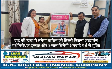 बांह की त्वचा में लगेगा माचिस की तिल्ली जितना सबडर्मल गर्भनिरोधक इंप्लांट और 3 साल मिलेगी अनचाहे गर्भ से मुक्ति