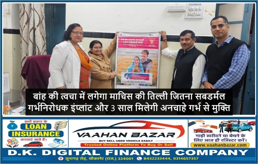 बांह की त्वचा में लगेगा माचिस की तिल्ली जितना सबडर्मल गर्भनिरोधक इंप्लांट और 3 साल मिलेगी अनचाहे गर्भ से मुक्ति